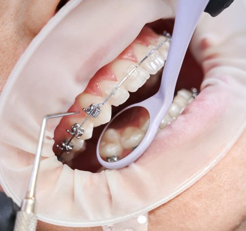 Orthodontie tanger
